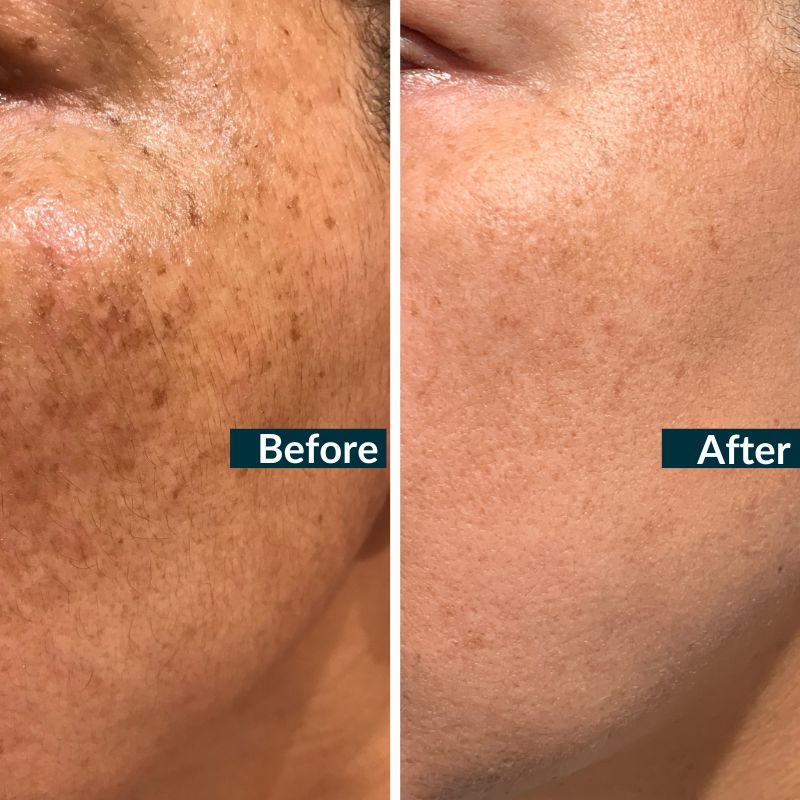 Retinol Plus Vitamin C Skin Refining Night Oil